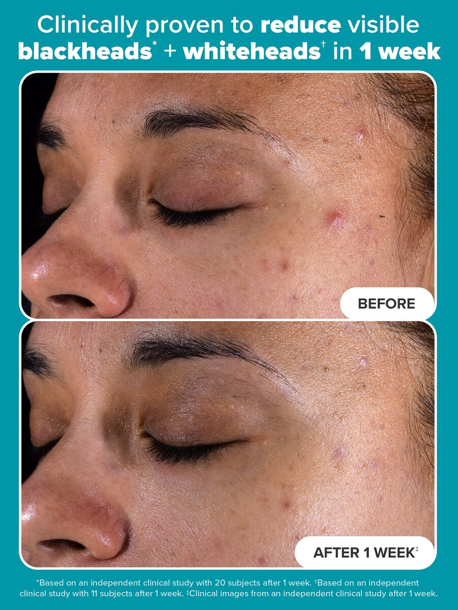 exfoliant liquide perfecteur de peau à 2 de bha