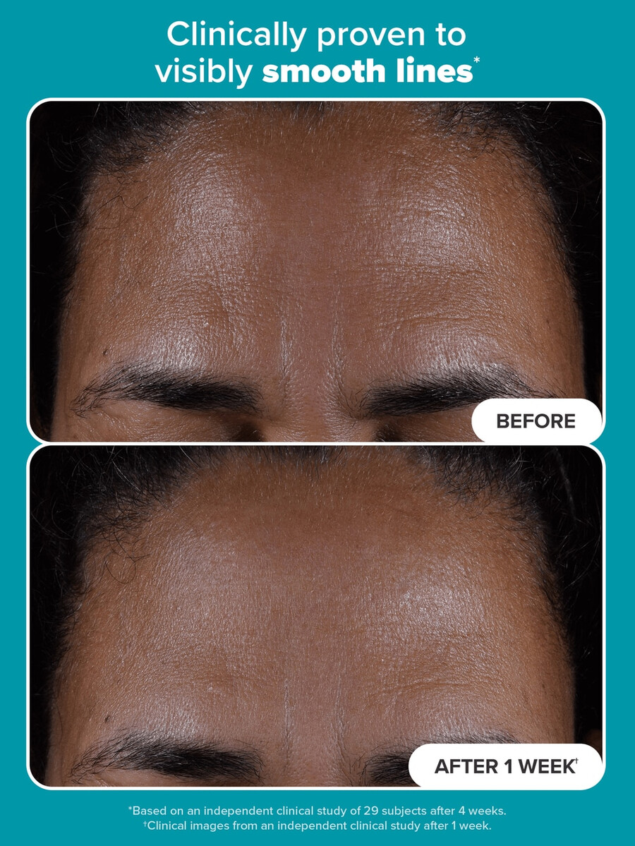 exfoliant liquide perfecteur de peau à 2 de bha