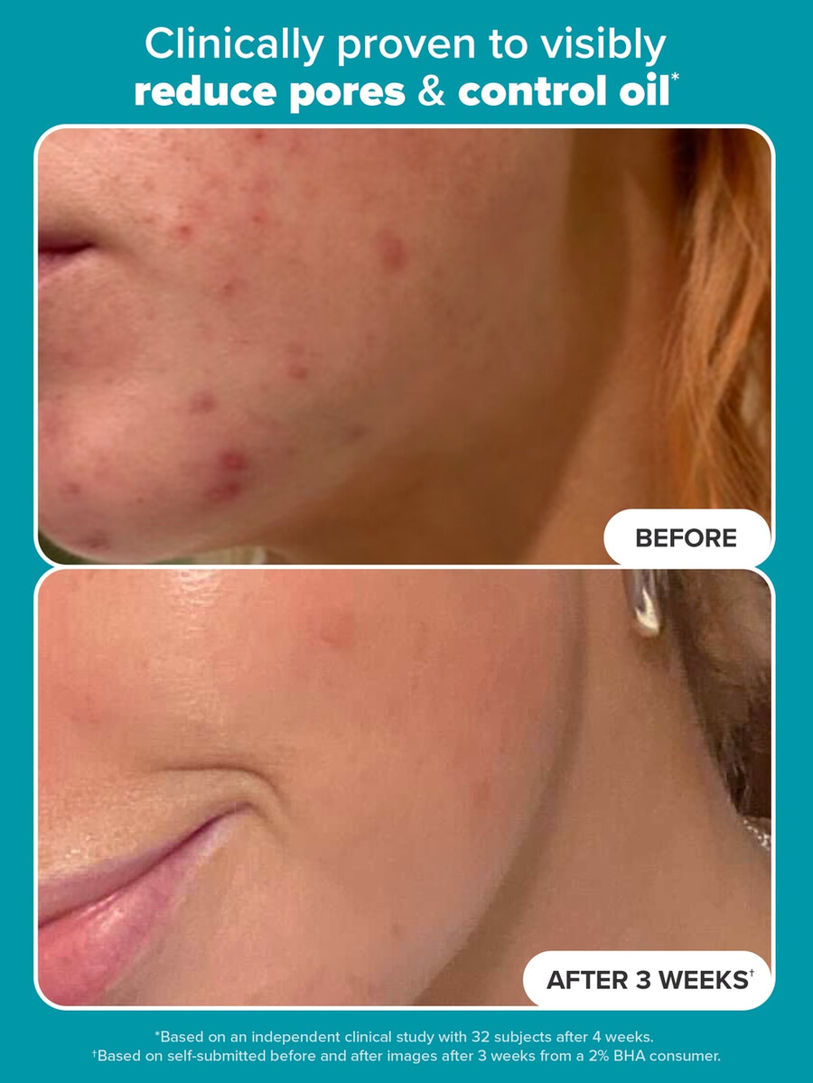 exfoliant liquide perfecteur de peau à 2 de bha